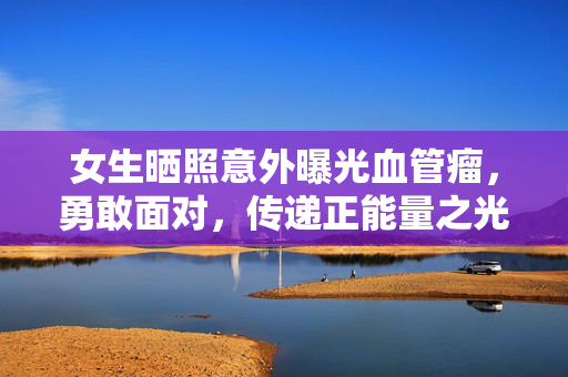 女生晒照意外曝光血管瘤，勇敢面对，传递正能量之光